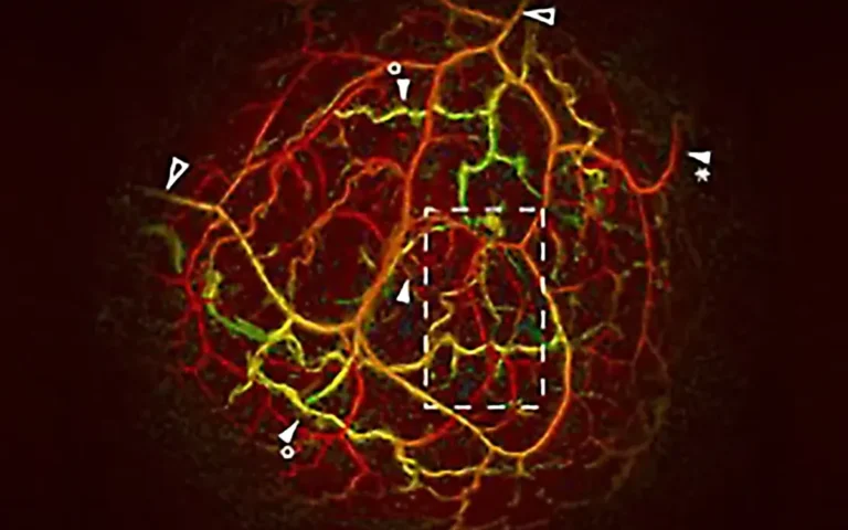 In vivo breast image made with the PAM3 system.